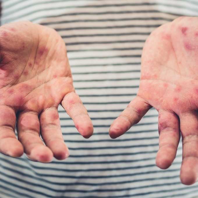 West Virginia Biohazard & Crime Scene Services